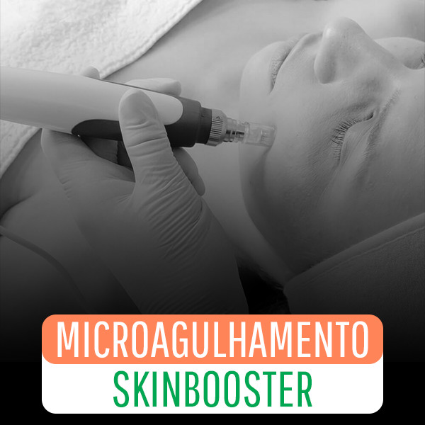 Capa - Microagulhamento Skinbooster