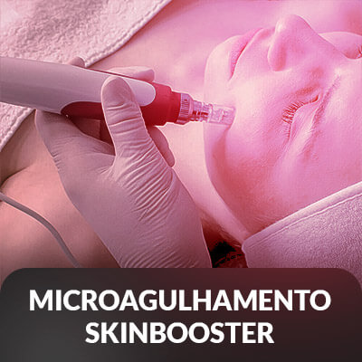 Microagulhamento-Skinbooster